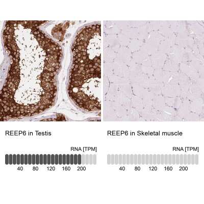 Immunohistochemistry-Paraffin: REEP6 Antibody [NBP2-37919] - Analysis in human testis and skeletal muscle tissues using NBP2-37919 antibody. Corresponding REEP6 RNA-seq data are presented for the same tissues.