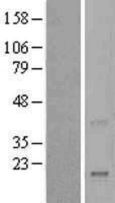 Western Blot: REG4 Overexpression Lysate (Adult Normal) [NBL1-15275] Left-Empty vector transfected control cell lysate (HEK293 cell lysate); Right -Over-expression Lysate for REG4.