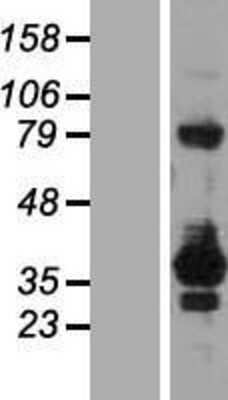 Western Blot: RELL2 Overexpression Lysate (Adult Normal) [NBP2-09499] Left-Empty vector transfected control cell lysate (HEK293 cell lysate); Right -Over-expression Lysate for RELL2.
