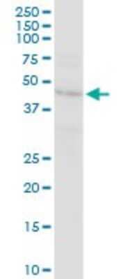 Western Blot: RELT/TNFRSF19L Antibody [H00084957-D01P] - Analysis of RELT expression in HeLa.