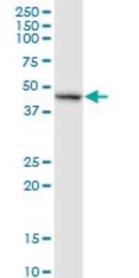 Western Blot: RELT/TNFRSF19L Antibody [H00084957-D01P] - Analysis of RELT expression in human pancreas.