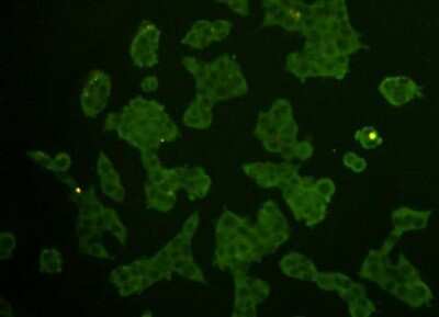 Immunocytochemistry/Immunofluorescence: REM2 Antibody (B4-D6) [NBP2-67104] - Staining Rem2 in NCCIT cells(green). Cells were fixed in paraformaldehyde, permeabilised with 0.25% Triton X100/PBS.