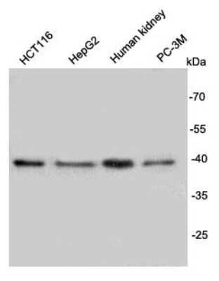Western Blot: REM2 Antibody (B4-D6) [NBP2-67104] - Analysis on different lysates using anti-Rem2 mouse mAb.