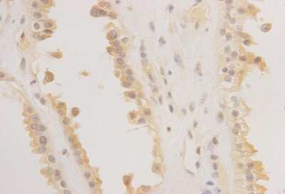 Immunohistochemistry: REM2 Antibody [NBP2-67107] - Image of Rem2 antibody on human spleen sections.