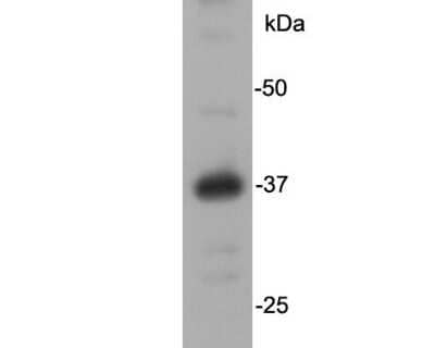 Western Blot: REM2 Antibody [NBP2-67107] - Analysis on NCCIT cell lysate using anti-Rem2 rabbit polyclonal antibody.