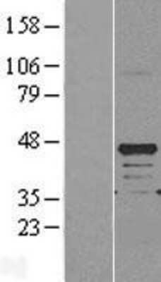 Western Blot: REM2 Overexpression Lysate (Adult Normal) [NBL1-15279] Left-Empty vector transfected control cell lysate (HEK293 cell lysate); Right -Over-expression Lysate for REM2.
