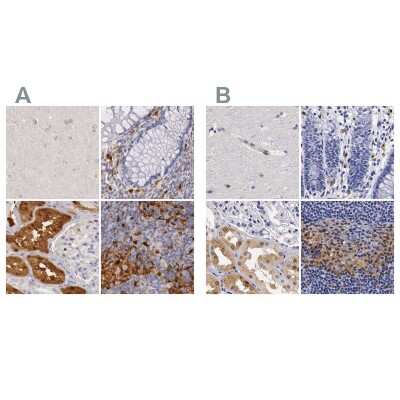 <b>Independent Antibodies Validation. </b>Immunohistochemistry-Paraffin: RENBP Antibody [NBP1-80852] - Staining of human cerebral cortex, colon, kidney and lymph node using Anti-RENBP antibody NBP1-80852 (A) shows similar protein distribution across tissues to independent antibody NBP1-80851 (B).