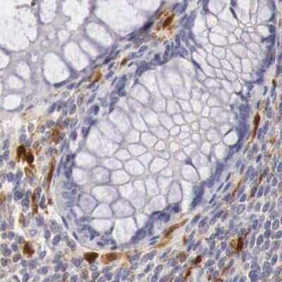 Immunohistochemistry-Paraffin: RENBP Antibody [NBP1-80852] - Staining of human colon.