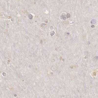 Immunohistochemistry-Paraffin: RENBP Antibody [NBP1-80852] - Staining of human cerebral cortex.