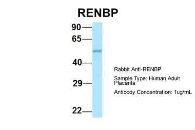 Western Blot: RENBP Antibody [NBP2-88139] - Host: Rabbit. Target Name: RENBP. Sample Type: Human Adult Placenta. Antibody Dilution: 1.0ug/ml