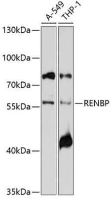 Western Blot: RENBP Antibody [NBP2-95119] - Analysis of extracts of various cell lines, using RENBP at 1:1000 dilution. Secondary antibody: HRP Goat Anti-Rabbit IgG (H+L) at 1:10000 dilution. Lysates/proteins: 25ug per lane. Blocking buffer: 3% nonfat dry milk in TBST. Detection: ECL Basic Kit . Exposure time: 5s.