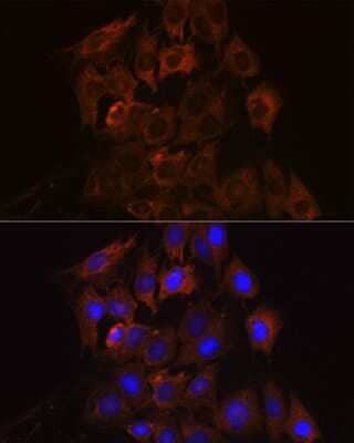 Immunocytochemistry/Immunofluorescence: RENT1/UPF1/hUPF1 Antibody (5D5C4) [NBP3-16544] - Immunofluorescence analysis of C6 cells using RENT1/UPF1/hUPF1 Rabbit mAb (NBP3-16544) at dilution of 1:100 (40x lens). Blue: DAPI for nuclear staining.