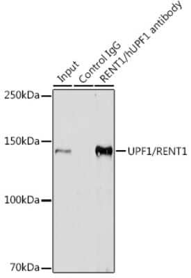 Immunoprecipitation: RENT1/UPF1/hUPF1 Antibody (5D5C4) [NBP3-16544] - Immunoprecipitation analysis of 300ug extracts of HeLa cells using 3ug RENT1/UPF1/hUPF1 antibody (NBP3-16544). Western blot was performed from the immunoprecipitate using RENT1/UPF1/hUPF1 antibody (NBP3-16544) at a dilition of 1:1000.