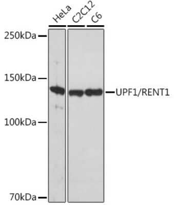 Western Blot: RENT1/UPF1/hUPF1 Antibody (5D5C4) [NBP3-16544] - Western blot analysis of extracts of various cell lines, using RENT1/UPF1/hUPF1 Rabbit mAb (NBP3-16544) at 1:1000 dilution. Secondary antibody: HRP Goat Anti-Rabbit IgG (H+L) at 1:10000 dilution. Lysates/proteins: 25ug per lane. Blocking buffer: 3% nonfat dry milk in TBST. Detection: ECL Basic Kit. Exposure time: 10s.