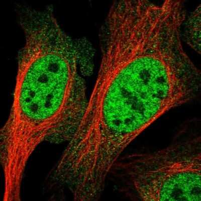 <b>Genetic Strategies Validation. </b>Immunocytochemistry/Immunofluorescence: RENT1/UPF1/hUPF1 Antibody [NBP1-89641] - Immunofluorescent staining of human cell line U-2 OS shows localization to nucleoplasm. Antibody staining is shown in green.