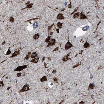 Immunohistochemistry: RENT1/UPF1/hUPF1 Antibody [NBP1-89642] - Staining of human cerebral cortex shows strong cytoplasmic and nuclear positivity in neuronal cells.