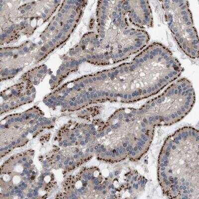 Immunohistochemistry-Paraffin: RENT1/UPF1/hUPF1 Antibody [NBP1-89641] - Staining of human duodenum shows strong granular positivity in glandular cells.