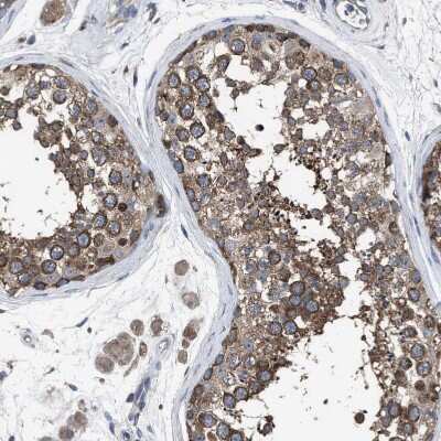 Immunohistochemistry-Paraffin: RENT1/UPF1/hUPF1 Antibody [NBP1-89642] - Staining of human testis shows moderate cytoplasmic positivity in cells in seminiferous ducts.