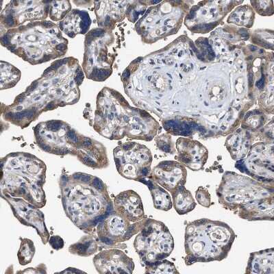 Immunohistochemistry-Paraffin: RENT1/UPF1/hUPF1 Antibody [NBP1-89642] - Staining of human placenta shows moderate cytoplasmic positivity in trophoblastic cells.