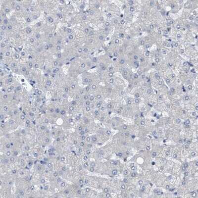 Immunohistochemistry-Paraffin: RENT1/UPF1/hUPF1 Antibody [NBP1-89642] - Staining of human liver shows no positivity in hepatocytes as expected.