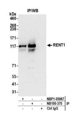 <b>Independent Antibodies Validation. </b>Immunoprecipitation: RENT1/UPF1/hUPF1 Antibody [NBP1-05967] - Detection of human RENT1 by western blot of immunoprecipitates. Samples: Whole cell lysate (1.0 mg per IP reaction; 20% of IP loaded) from HEK293T cells prepared using NETN lysis buffer. Antibodies: Affinity purified rabbit anti-RENT1 antibody NBP1-05967 used for IP at 3 ug per reaction. RENT1 was also immunoprecipitated by rabbit anti-RENT1 antibody NB100-370. For blotting immunoprecipitated RENT1, NBP1-05967 was used at 1 ug/ml. Detection: Chemiluminescence with an exposure time of 10 seconds.