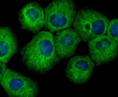 Immunocytochemistry/Immunofluorescence: RENT1/UPF1/hUPF1 Antibody (JG38-44) [NBP2-76842] - RENT1/UPF1/Hupf1 Antibody (JG38-44) [NBP2-76842] - ICC staining hUPF1 in A431 cells (green). The nuclear counter stain is DAPI (blue). Cells were fixed in paraformaldehyde, permeabilised with 0.25% Triton X100/PBS.