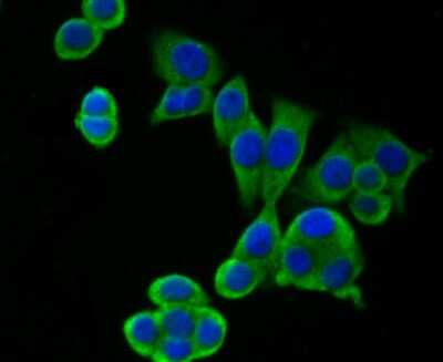 Immunocytochemistry/Immunofluorescence: RENT1/UPF1/hUPF1 Antibody (JG38-44) [NBP2-76842] - RENT1/UPF1/Hupf1 Antibody (JG38-44) [NBP2-76842] - ICC staining hUPF1 in LOVO cells (green). The nuclear counter stain is DAPI (blue). Cells were fixed in paraformaldehyde, permeabilised with 0.25% Triton X100/PBS.