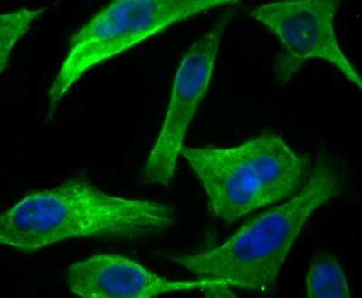 Immunocytochemistry/Immunofluorescence: RENT1/UPF1/hUPF1 Antibody (JG38-44) [NBP2-76842] - RENT1/UPF1/Hupf1 Antibody (JG38-44) [NBP2-76842] - ICC staining hUPF1 in PC-3M cells (green). The nuclear counter stain is DAPI (blue). Cells were fixed in paraformaldehyde, permeabilised with 0.25% Triton X100/PBS.