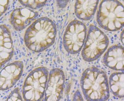 Immunohistochemistry: RENT1/UPF1/hUPF1 Antibody (JG38-44) [NBP2-76842] - Immunohistochemical analysis of paraffin-embedded human colon tissue using anti- hUPF1 antibody. Counter stained with hematoxylin.