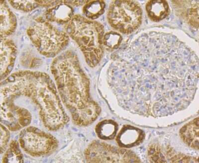 Immunohistochemistry: RENT1/UPF1/hUPF1 Antibody (JG38-44) [NBP2-76842] - Immunohistochemical analysis of paraffin-embedded human kidney tissue using anti- hUPF1 antibody. Counter stained with hematoxylin.