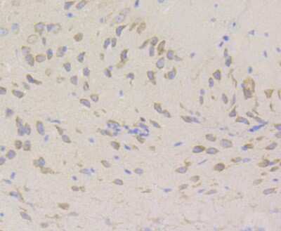 Immunohistochemistry: RENT1/UPF1/hUPF1 Antibody (JG38-44) [NBP2-76842] - Immunohistochemical analysis of paraffin-embedded mouse brain tissue using anti- hUPF1 antibody. Counter stained with hematoxylin.