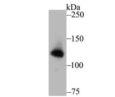 Western Blot: RENT1/UPF1/hUPF1 Antibody (JG38-44) [NBP2-76842] - Western blot analysis of hUPF1 on PC-3M cell lysate using anti-hUPF1 antibody at 1/1,000 dilution.