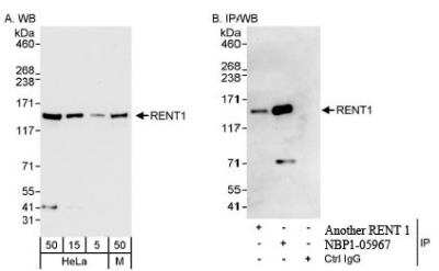 Western Blot: RENT1/UPF1/hUPF1 Antibody [NBP1-05967] - Whole cell  lysate from HeLa  and mouse NIH3T3.