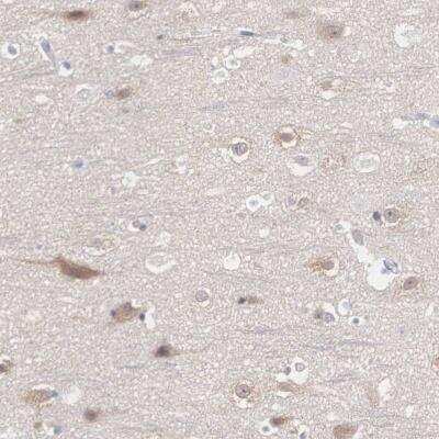 Immunohistochemistry-Paraffin: REPS2 Antibody [NBP1-80892] - Staining of human cerebral cortex shows moderate cytoplasmic positivity in neuronal cells.