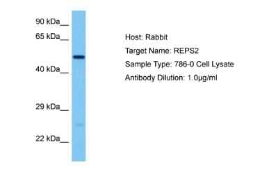 Western Blot: REPS2 Antibody [NBP2-85624] - Host: Rabbit. Target Name: REPS2. Sample Tissue: Human 786-0 Whole Cell lysates. Antibody Dilution: 1ug/ml