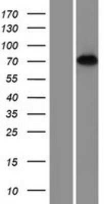 Western Blot: REPS2 Overexpression Lysate (Adult Normal) [NBP2-07838] Left-Empty vector transfected control cell lysate (HEK293 cell lysate); Right -Over-expression Lysate for REPS2.