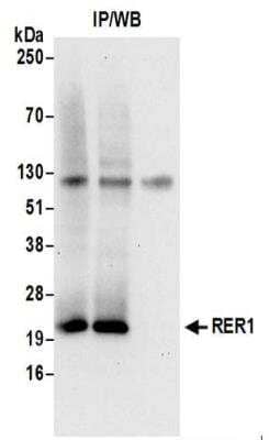 Immunoprecipitation: RER1 Antibody [NBP2-37700] - Whole cell lysate (0.5 or 1.0 mg per IP reaction; 20% of IP loaded) from 293T cells prepared using NETN lysis buffer.    Affinity purified rabbit anti-RER1 antibody used for IP at 6 ug per reaction.  RER1 was also immunoprecipitated by rabbit anti-RER1 antibody.  For blotting immunoprecipitated RER1,  was used at 1 ug/ml.  Detection: Chemiluminescence with an exposure time of 10 seconds.