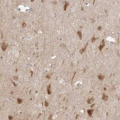 Immunohistochemistry-Paraffin: RERE Antibody [NBP1-88838] - Staining of human cerebral cortex shows moderate positivity in neurons.