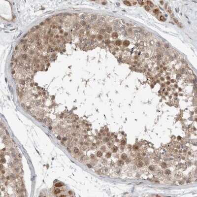 Immunohistochemistry-Paraffin: RERE Antibody [NBP1-88838] - Staining of human testis shows strong nuclear positivity in cells in seminiferous ducts.