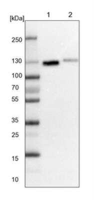 Western Blot: RERE Antibody [NBP1-88838] - Lane 1: NIH-3T3 cell lysate (Mouse embryonic fibroblast cells). Lane 2: NBT-II cell lysate (Rat Wistar bladder tumor cells).