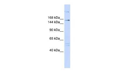 Western Blot: RERE Antibody [NBP2-85626] - WB Suggested Anti-RERE Antibody Titration: 0.2-1 ug/ml. ELISA Titer: 1:62500. Positive Control: 293T cell lysate