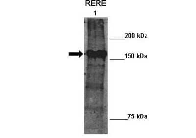 Western Blot: RERE Antibody [NBP2-85626] - Lane 1: 10ug mouse ATN2 transfected Drosophila extract. Primary Antibody Dilution:  1:100.  Secondary Antibody: Anti-rabbit-HRP. Secondary Antibody Dilution:  1:2000. Gene Name: RERE. Submitted by: Manolis Fanto, King's College London