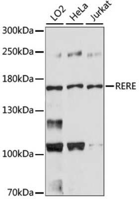 Western Blot: RERE Antibody [NBP2-94613] - Analysis of extracts of various cell lines, using RERE at 1:10000 dilution. Lysates/proteins: 25ug per lane. Blocking buffer: 3% nonfat dry milk in TBST. Detection: ECL Basic Kit . Exposure time: 90s.