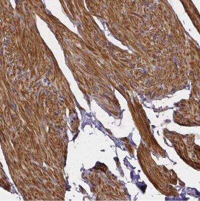 Immunohistochemistry-Paraffin: RERG Antibody [NBP1-82746] - Staining of human smooth muscle shows cytoplasmic positivity in smooth muscle cells.