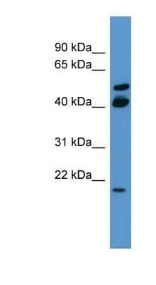 Western Blot: RERG Antibody [NBP1-68972] - COLO205 cells lysate, concentration 0.2-1 ug/ml.