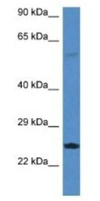 Western Blot: RERG Antibody [NBP1-79772] - Rat Lung Lysate 1ug/ml  Gel Concentration 12%