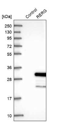 Western Blot: RERG Antibody [NBP1-82746] - Analysis in control (vector only transfected HEK293T lysate) and RERG over-expression lysate (Co-expressed with a C-terminal myc-DDK tag (3.1 kDa) in mammalian HEK293T cells).