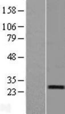Western Blot: RERG Overexpression Lysate (Adult Normal) [NBL1-15284] Left-Empty vector transfected control cell lysate (HEK293 cell lysate); Right -Over-expression Lysate for RERG.