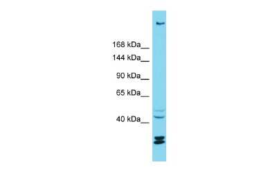Western Blot: RESF1 Antibody [NBP2-84537] - Host: Rabbit. Target Name: KIAA1551. Sample Type: ACHN Whole cell lysates. Antibody Dilution: 1.0ug/ml