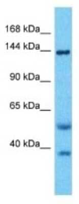 Western Blot: REV1 Antibody [NBP3-09940] - Western blot analysis of REV1 in Fetal Lung lysates. Antibody dilution at 1.0ug/ml